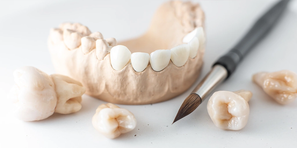 Wurzelbehandelten Zahn überkronen